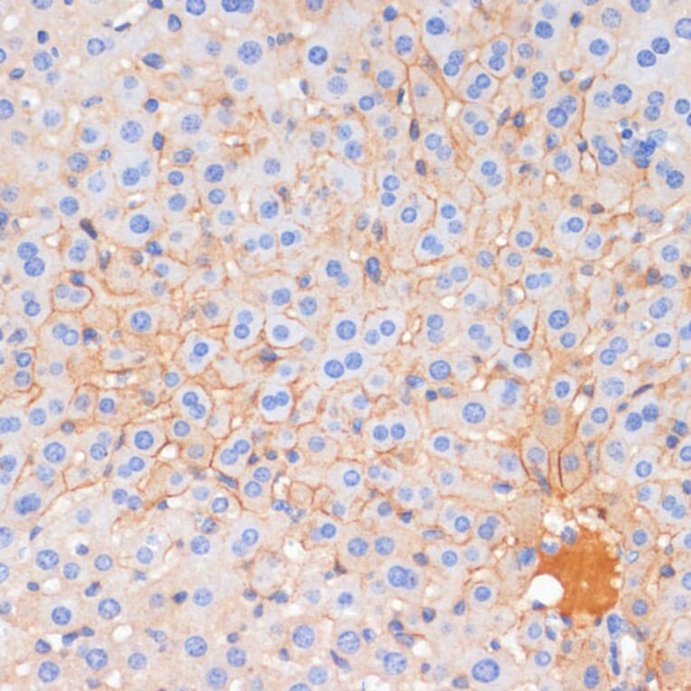 Immunohistochemistry - Anti-E Cadherin Antibody (A14318) - Antibodies.com