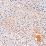Immunohistochemistry - Anti-E Cadherin Antibody (A14318) - Antibodies.com