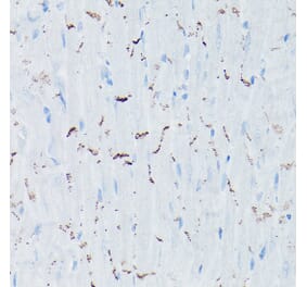 Immunohistochemistry - Anti-N Cadherin Antibody (A14319) - Antibodies.com