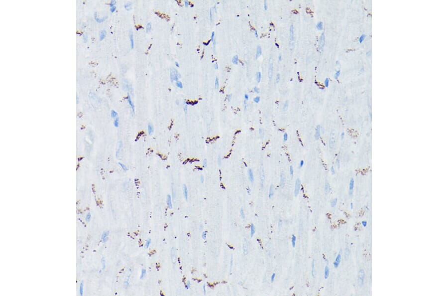 Immunohistochemistry - Anti-N Cadherin Antibody (A14319) - Antibodies.com