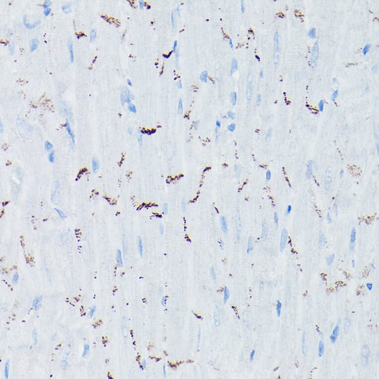 Immunohistochemistry - Anti-N Cadherin Antibody (A14319) - Antibodies.com