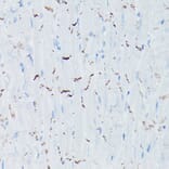 Immunohistochemistry - Anti-N Cadherin Antibody (A14319) - Antibodies.com