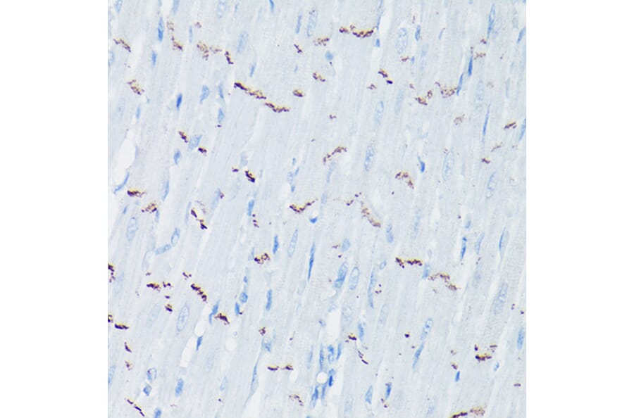 Immunohistochemistry - Anti-N Cadherin Antibody (A14319) - Antibodies.com