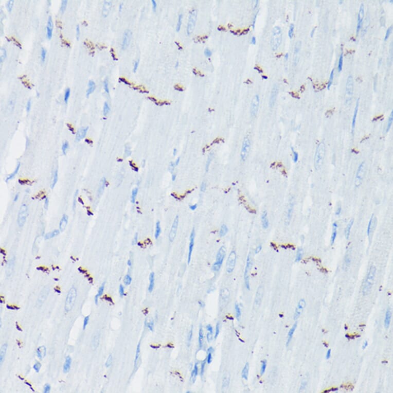 Immunohistochemistry - Anti-N Cadherin Antibody (A14319) - Antibodies.com