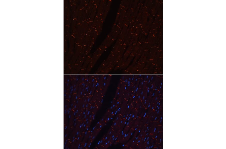 Immunofluorescence - Anti-N Cadherin Antibody (A14319) - Antibodies.com