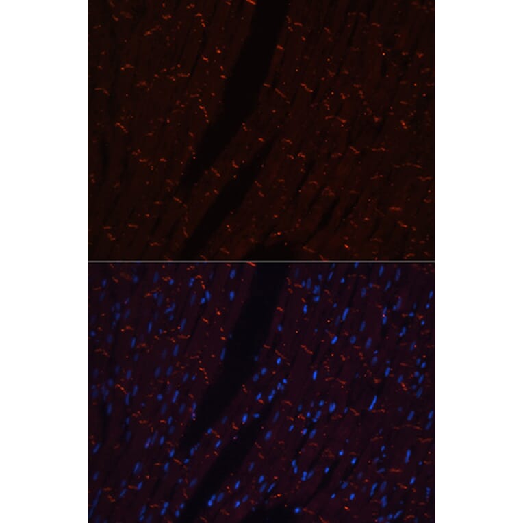 Immunofluorescence - Anti-N Cadherin Antibody (A14319) - Antibodies.com