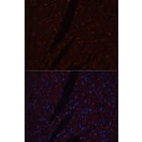 Immunofluorescence - Anti-N Cadherin Antibody (A14319) - Antibodies.com