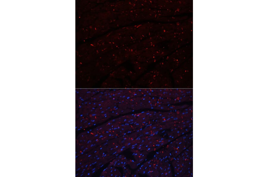 Immunofluorescence - Anti-N Cadherin Antibody (A14319) - Antibodies.com