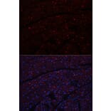 Immunofluorescence - Anti-N Cadherin Antibody (A14319) - Antibodies.com