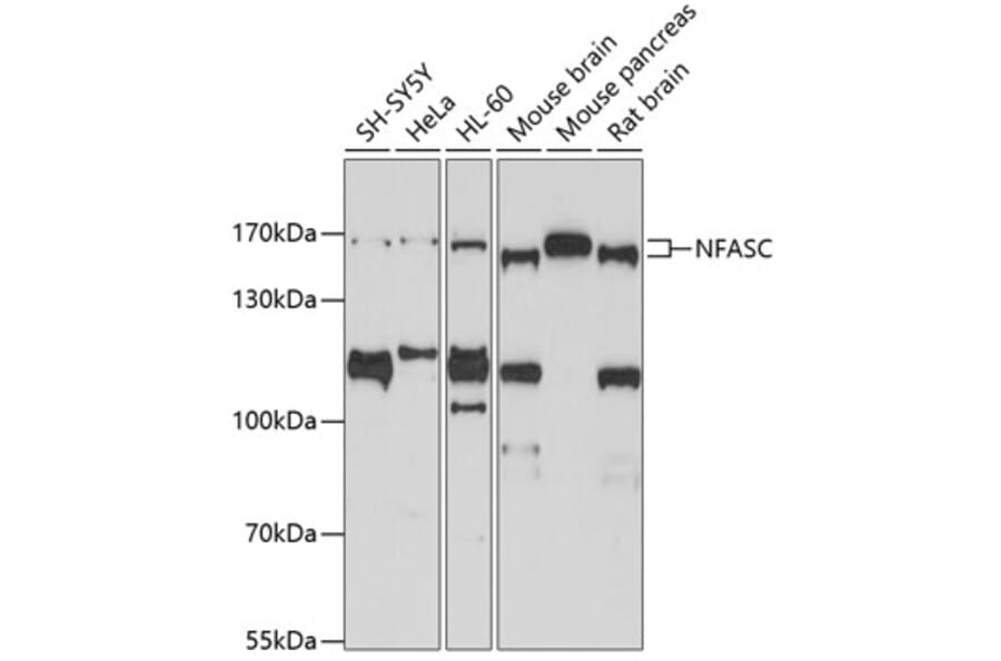 Western Blot - Anti-Neurofascin Antibody (A14324) - Antibodies.com