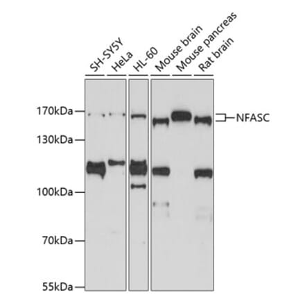 Western Blot - Anti-Neurofascin Antibody (A14324) - Antibodies.com