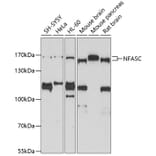 Western Blot - Anti-Neurofascin Antibody (A14324) - Antibodies.com