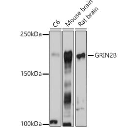 Western Blot - Anti-NMDAR2B Antibody (A14325) - Antibodies.com
