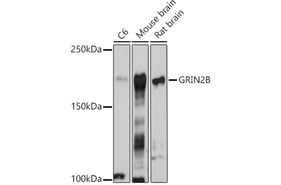 Western Blot - Anti-NMDAR2B Antibody (A14325) - Antibodies.com