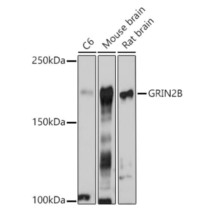 Western Blot - Anti-NMDAR2B Antibody (A14325) - Antibodies.com