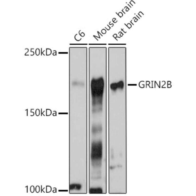 Western Blot - Anti-NMDAR2B Antibody (A14325) - Antibodies.com