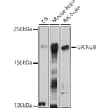 Western Blot - Anti-NMDAR2B Antibody (A14325) - Antibodies.com