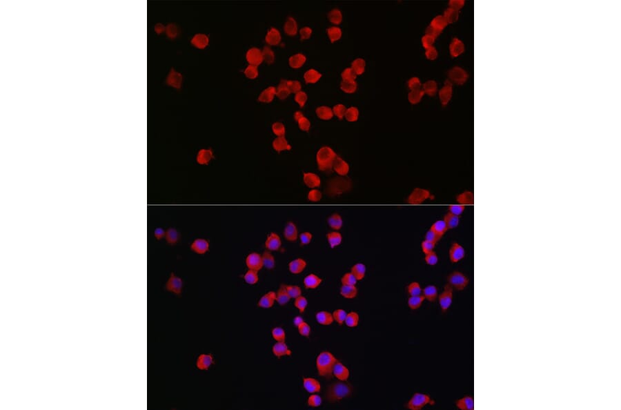 Immunofluorescence - Anti-NMDAR2B Antibody (A14325) - Antibodies.com