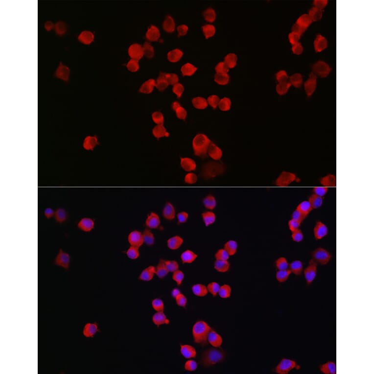 Immunofluorescence - Anti-NMDAR2B Antibody (A14325) - Antibodies.com