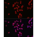 Immunofluorescence - Anti-NMDAR2B Antibody (A14325) - Antibodies.com