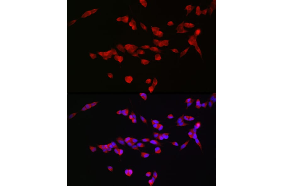 Immunofluorescence - Anti-NMDAR2B Antibody (A14325) - Antibodies.com