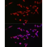 Immunofluorescence - Anti-NMDAR2B Antibody (A14325) - Antibodies.com