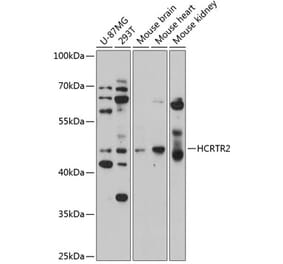 Western Blot - Anti-Orexin Receptor 2 Antibody (A14326) - Antibodies.com