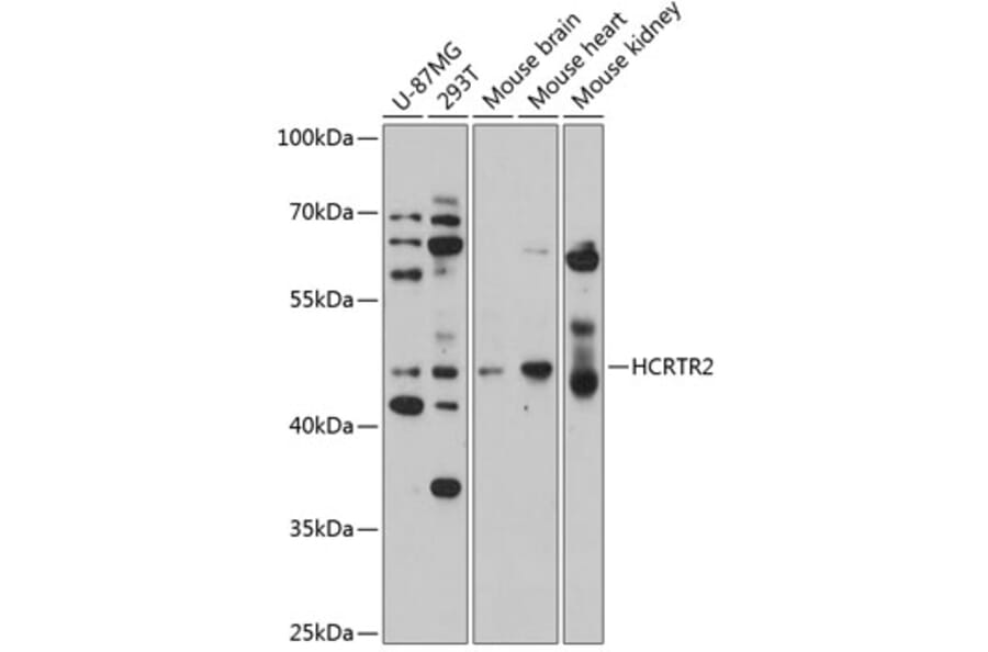 Western Blot - Anti-Orexin Receptor 2 Antibody (A14326) - Antibodies.com