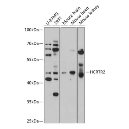 Western Blot - Anti-Orexin Receptor 2 Antibody (A14326) - Antibodies.com