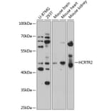 Western Blot - Anti-Orexin Receptor 2 Antibody (A14326) - Antibodies.com
