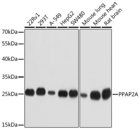 Western Blot - Anti-PPAP2A Antibody (A14328) - Antibodies.com