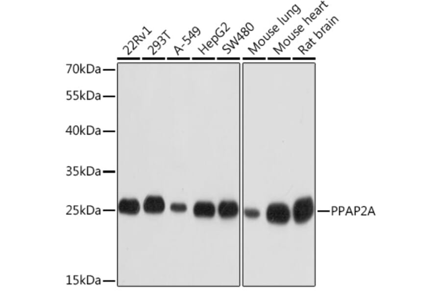 Western Blot - Anti-PPAP2A Antibody (A14328) - Antibodies.com