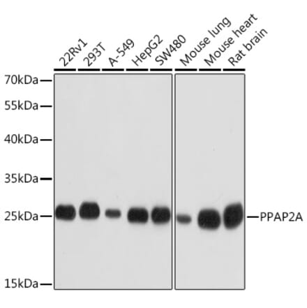 Western Blot - Anti-PPAP2A Antibody (A14328) - Antibodies.com