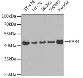 Western Blot - Anti-PAR4 Antibody (A14329) - Antibodies.com
