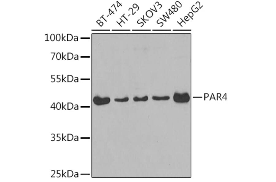 Western Blot - Anti-PAR4 Antibody (A14329) - Antibodies.com