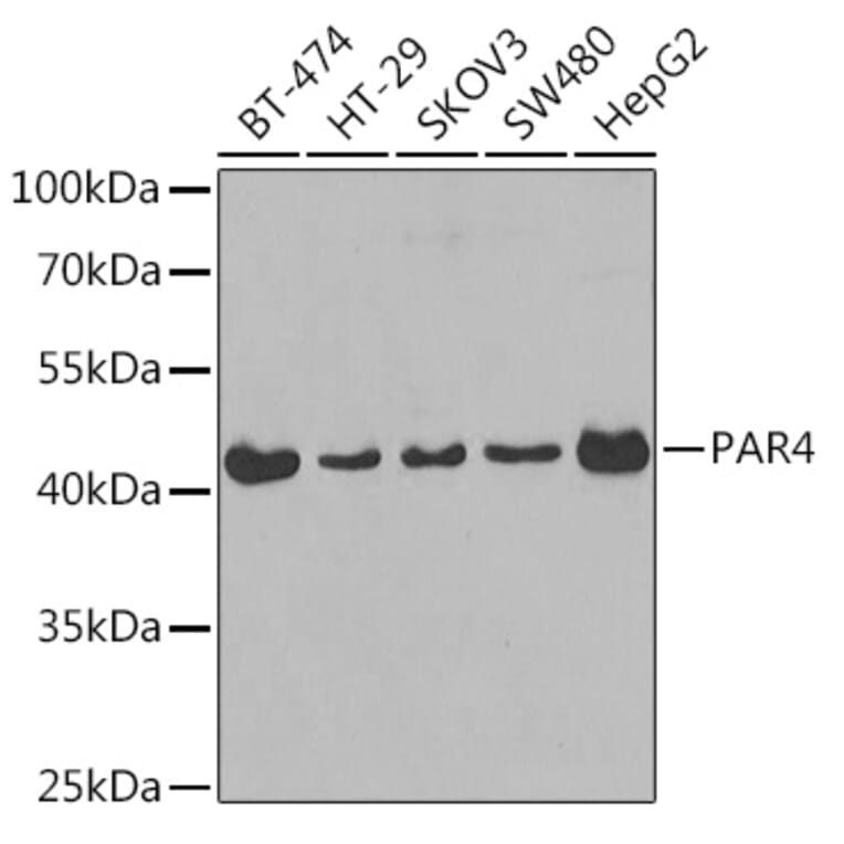 Western Blot - Anti-PAR4 Antibody (A14329) - Antibodies.com