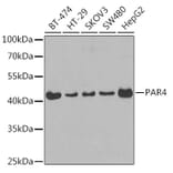 Western Blot - Anti-PAR4 Antibody (A14329) - Antibodies.com