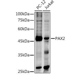 Western Blot - Anti-Pax2 Antibody (A14331) - Antibodies.com