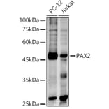 Western Blot - Anti-Pax2 Antibody (A14331) - Antibodies.com
