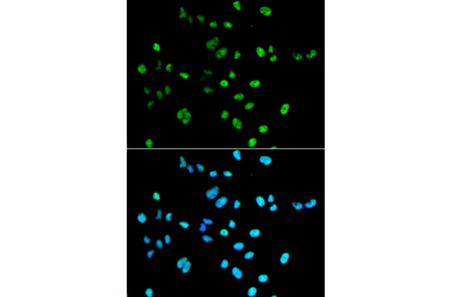 Immunofluorescence - Anti-Pax2 Antibody (A14331) - Antibodies.com