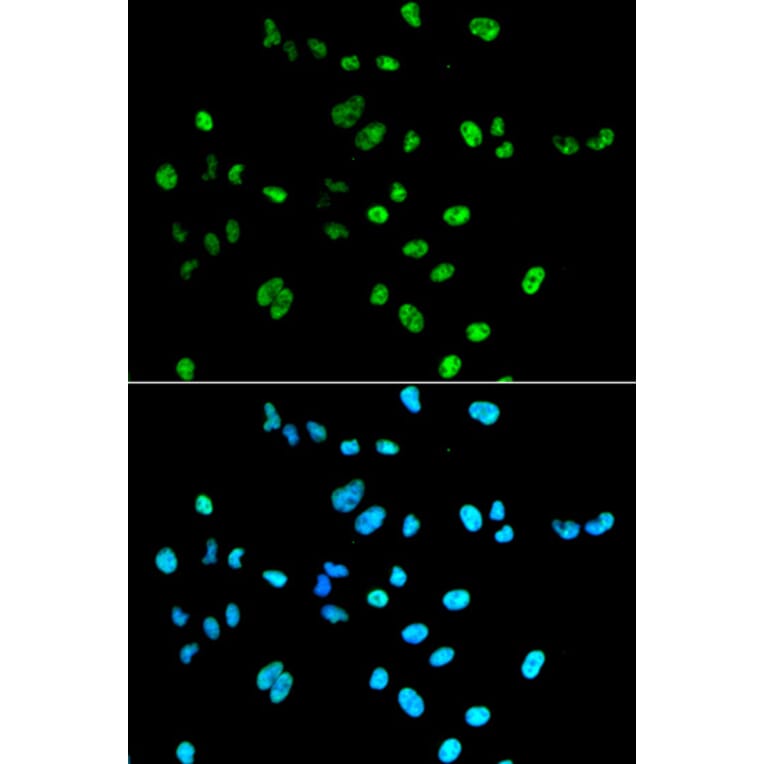 Immunofluorescence - Anti-Pax2 Antibody (A14331) - Antibodies.com