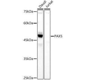 Western Blot - Anti-PAX5 Antibody (A14332) - Antibodies.com