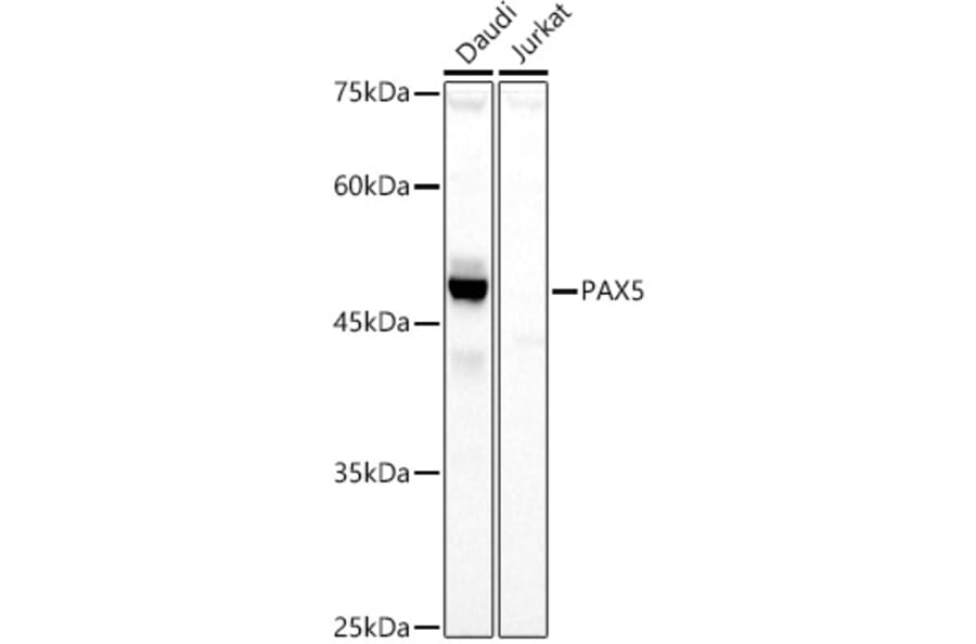 Western Blot - Anti-PAX5 Antibody (A14332) - Antibodies.com