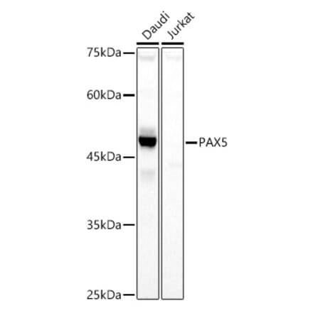Western Blot - Anti-PAX5 Antibody (A14332) - Antibodies.com
