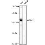 Western Blot - Anti-PAX5 Antibody (A14332) - Antibodies.com