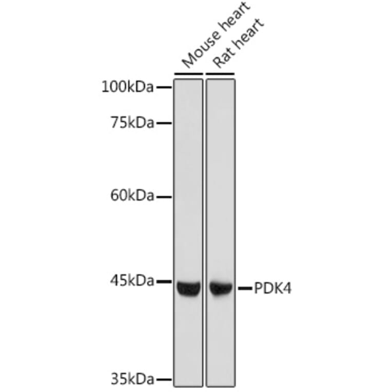 Western Blot - Anti-PDK4 Antibody (A14333) - Antibodies.com