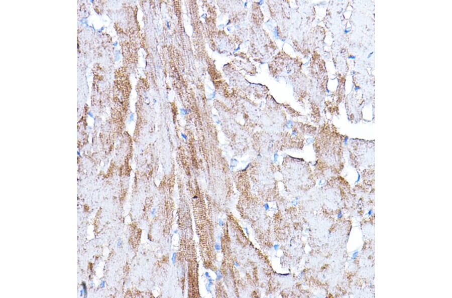 Immunohistochemistry - Anti-PDK4 Antibody (A14333) - Antibodies.com
