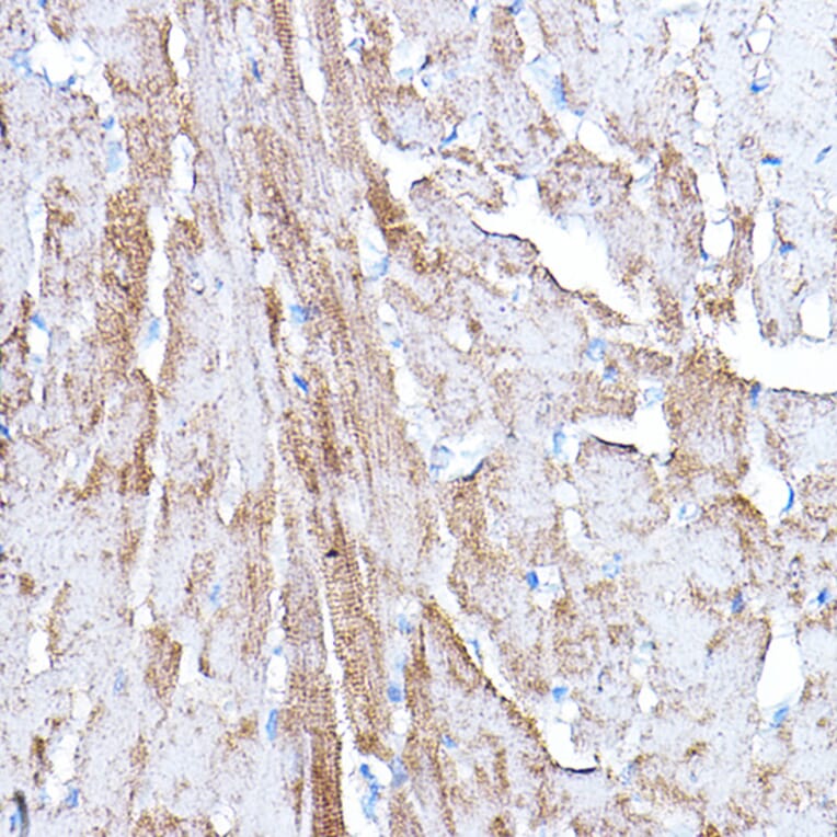 Immunohistochemistry - Anti-PDK4 Antibody (A14333) - Antibodies.com