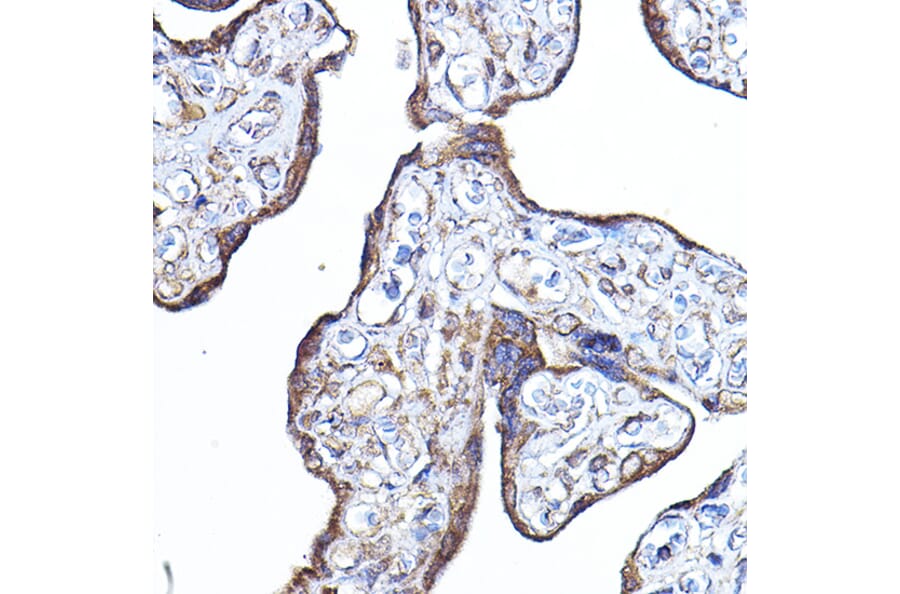 Immunohistochemistry - Anti-PDK4 Antibody (A14333) - Antibodies.com