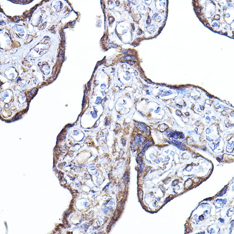 Immunohistochemistry - Anti-PDK4 Antibody (A14333) - Antibodies.com